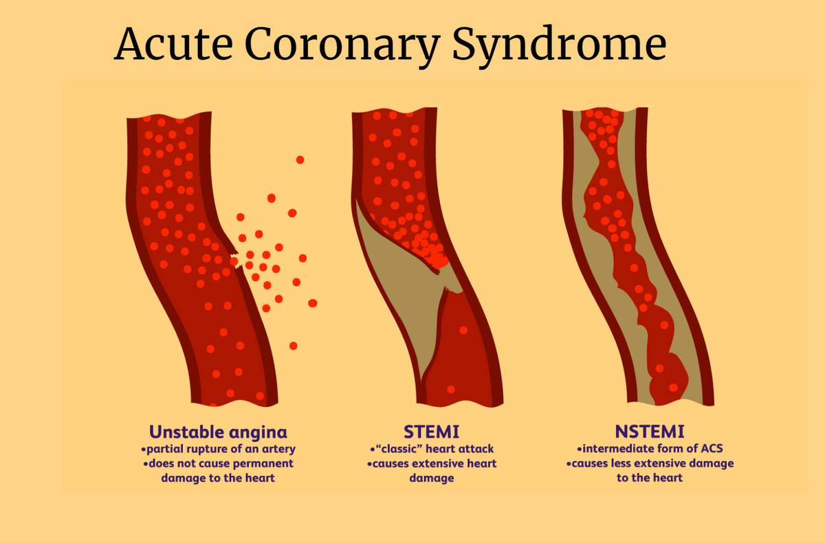 Common medical conditions